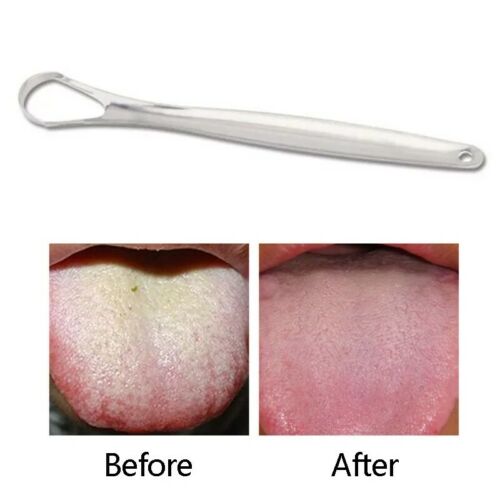 1PC Useful Tongue Scraper Stainless Steel Oral Tongue Cleaner Medical Mouth